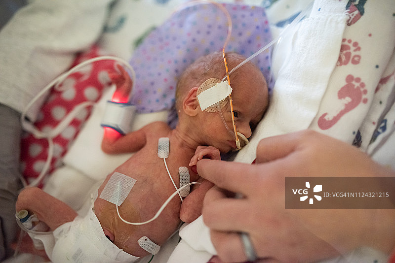 在保温箱中母亲触摸的29周早产儿图片素材