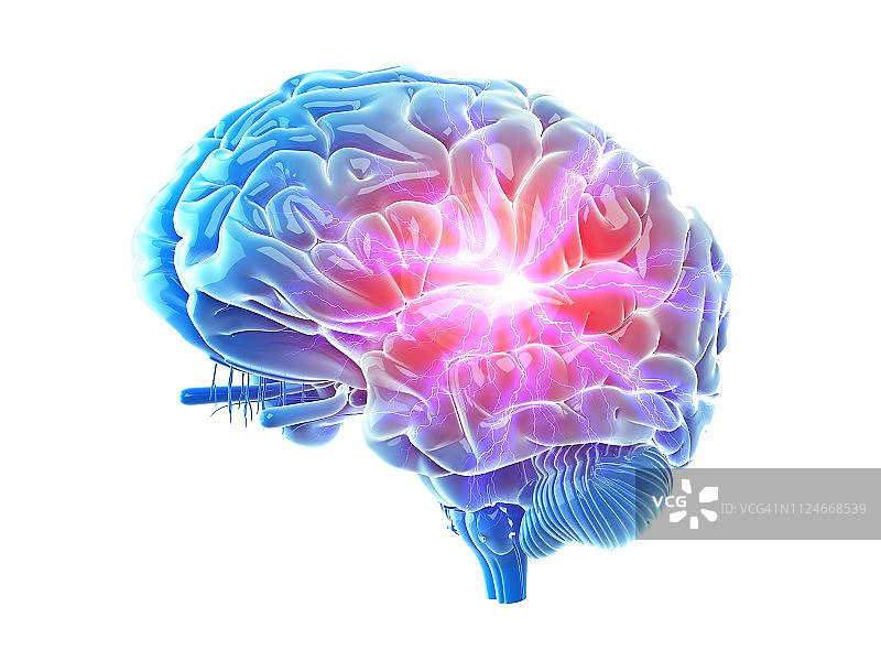 痛苦的大脑插画图片素材