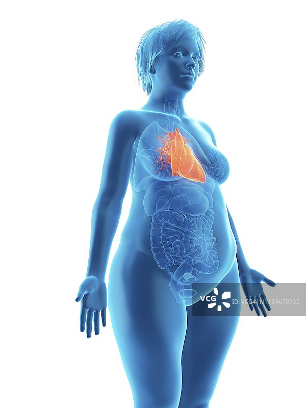 肥胖女性的心脏插画图片素材