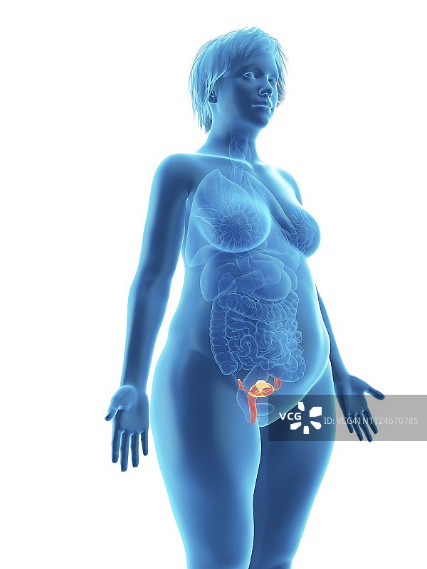 肥胖女性的子宫插图图片素材