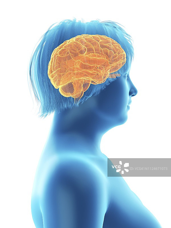 肥胖妇女的大脑插画图片素材