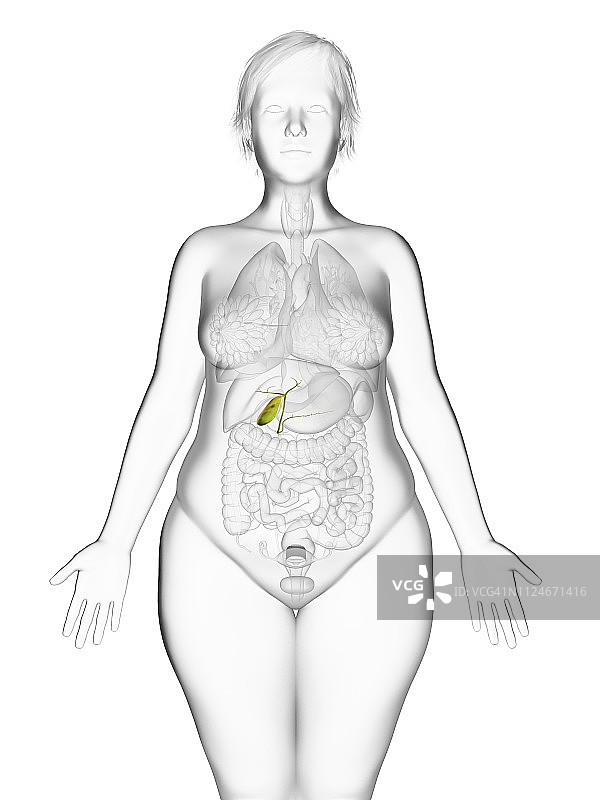 肥胖女性的胆囊插图图片素材