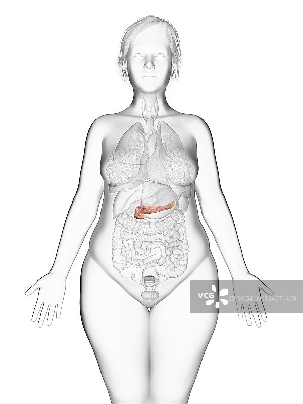 肥胖女人胰腺插图图片素材