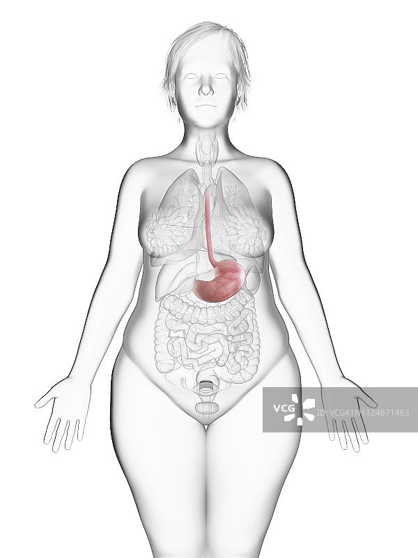 肥胖妇女的腹部插画图片素材