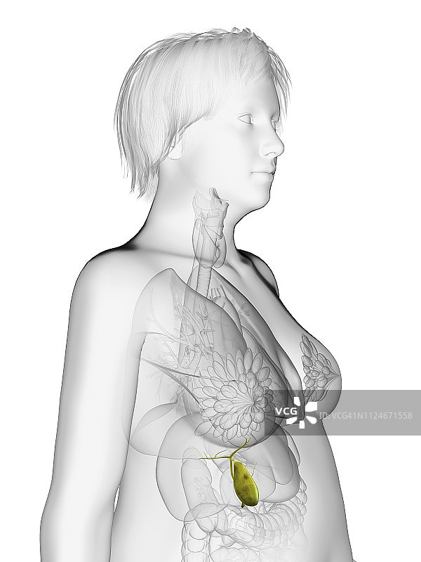 肥胖女性的胆囊插图图片素材