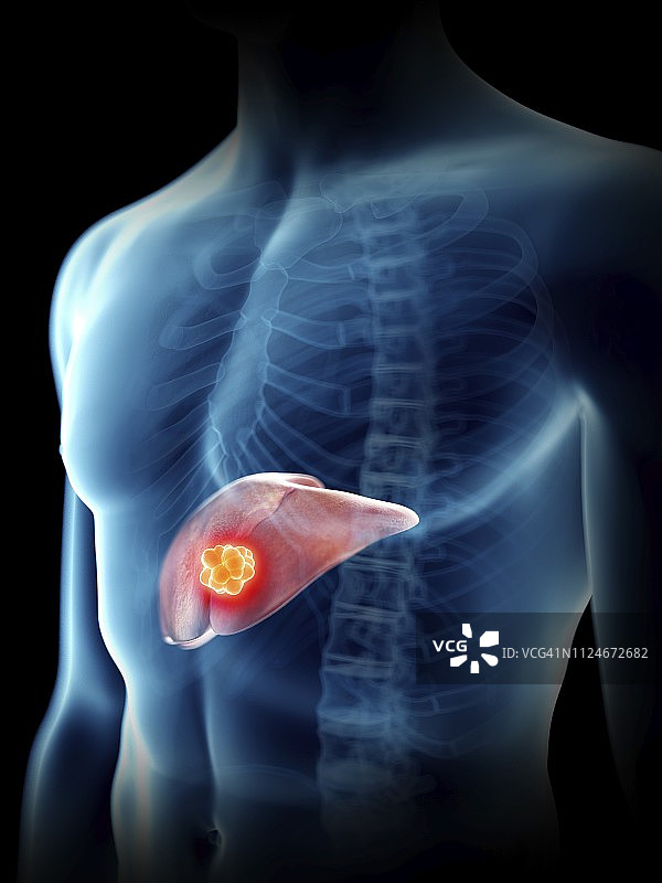 男性肝脏疾病插画图片素材