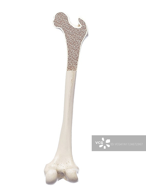 骨质疏松症插画图片素材