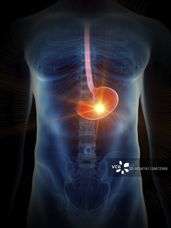 胃部疼痛插画图片素材