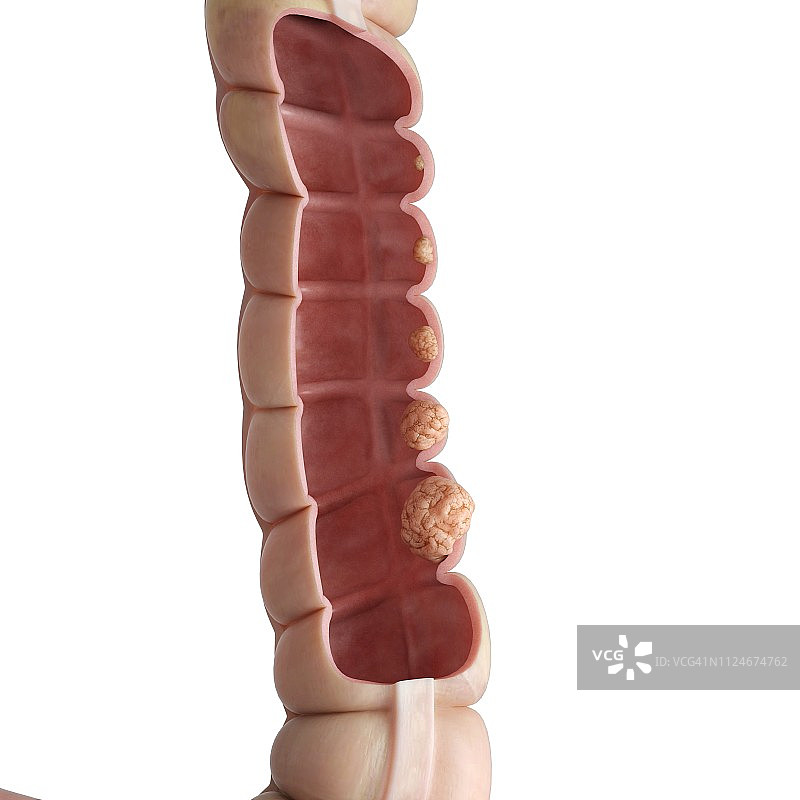 人类结肠示意图图片素材