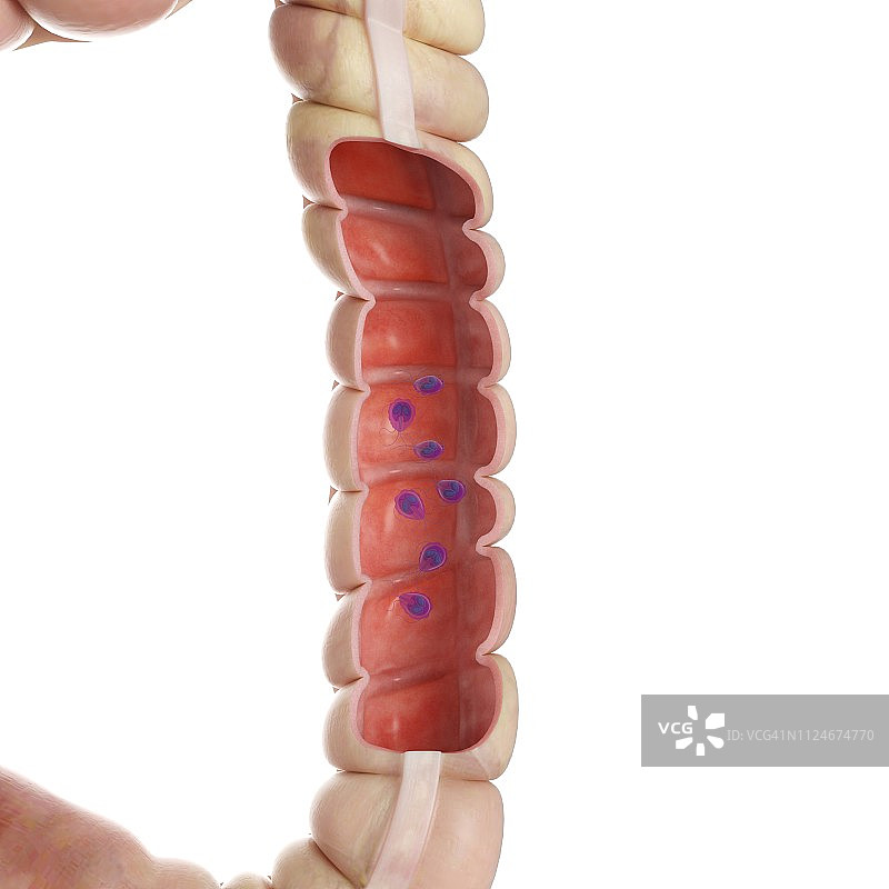 结肠内贾第虫寄生虫插画图片素材