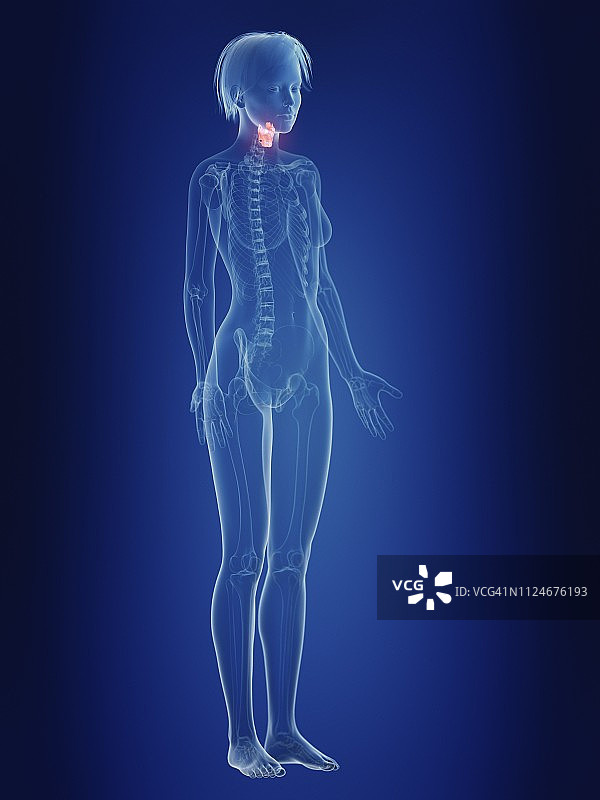 女性喉咙疼痛插画图片素材