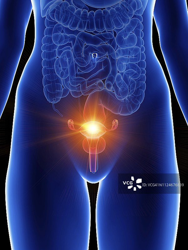 女性疼痛的子宫插画图片素材