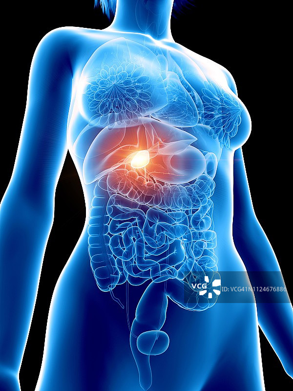 女性疼痛的胆囊插画图片素材