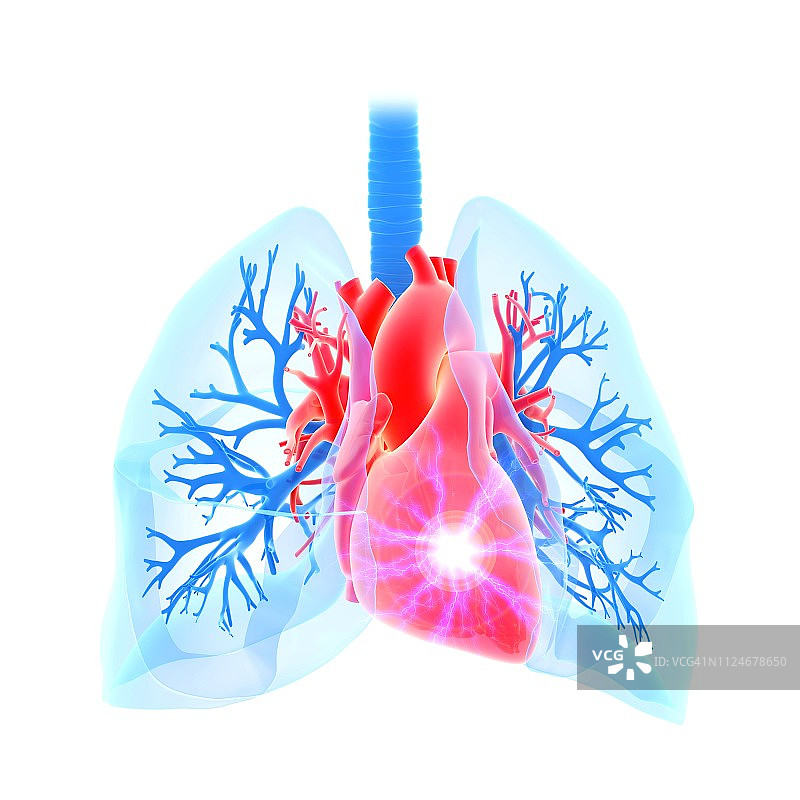 心脏病发作概念插图图片素材