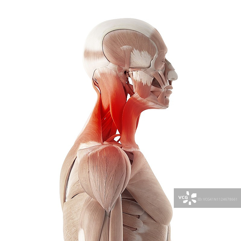 疼痛的颈部肌肉插画图片素材