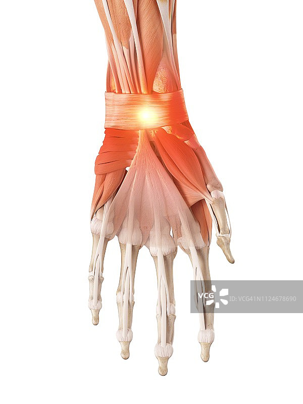 手腕疼痛插画图片素材