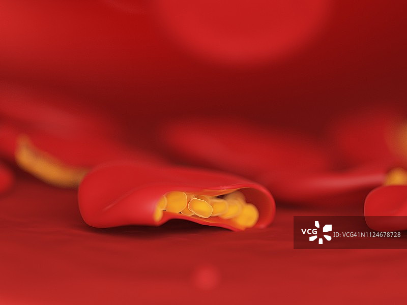 疟疾感染血细胞插画图片素材