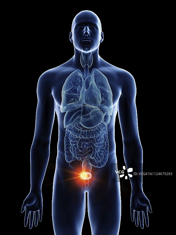 男人膀胱癌插画图片素材