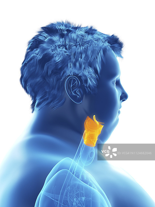 肥胖男人喉咙插画图片素材