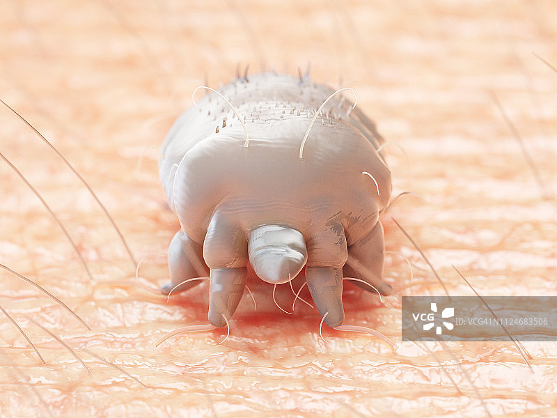 疥螨插画图片素材