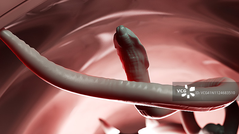 人体结肠内的蛔虫插画图片素材