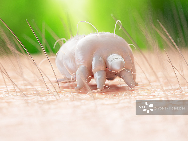 人类皮肤上疥疮螨的插图图片素材