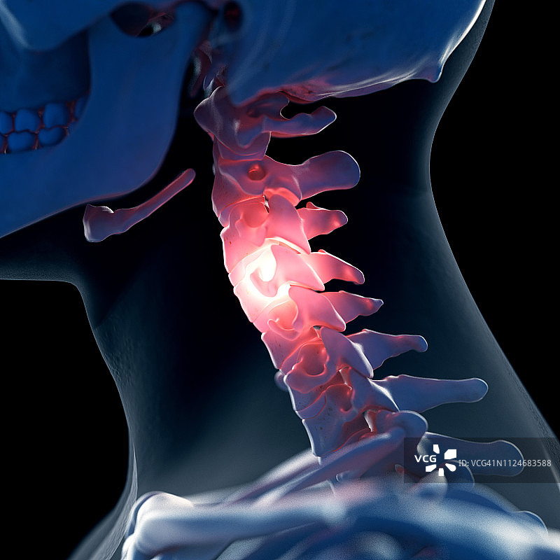 颈部疼痛插画图片素材