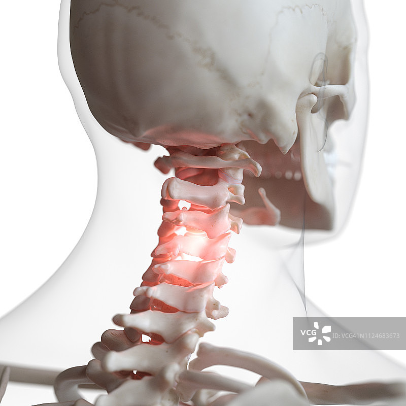 疼痛的颈椎插画图片素材
