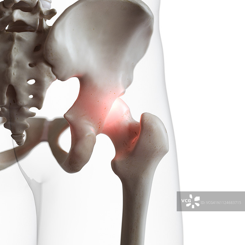 髋关节疼痛插画图片素材