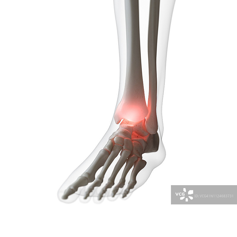 脚踝疼痛插画图片素材