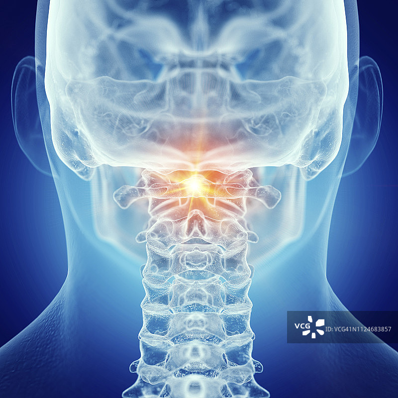 疼痛的寰椎插画图片素材