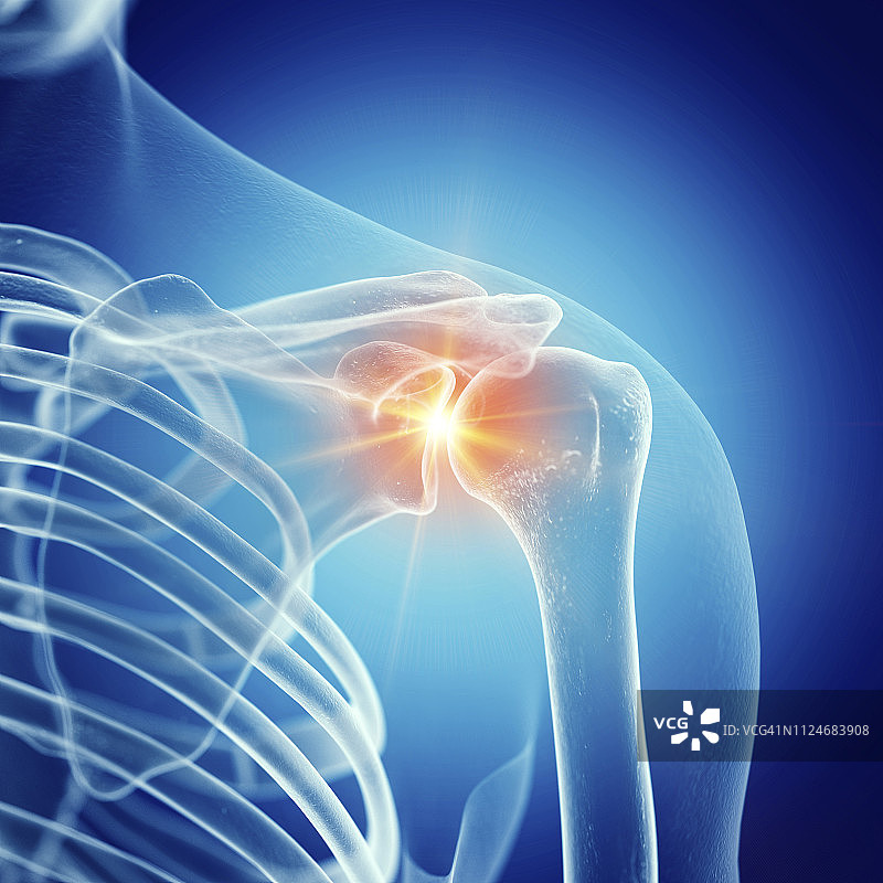 肩关节疼痛插画图片素材