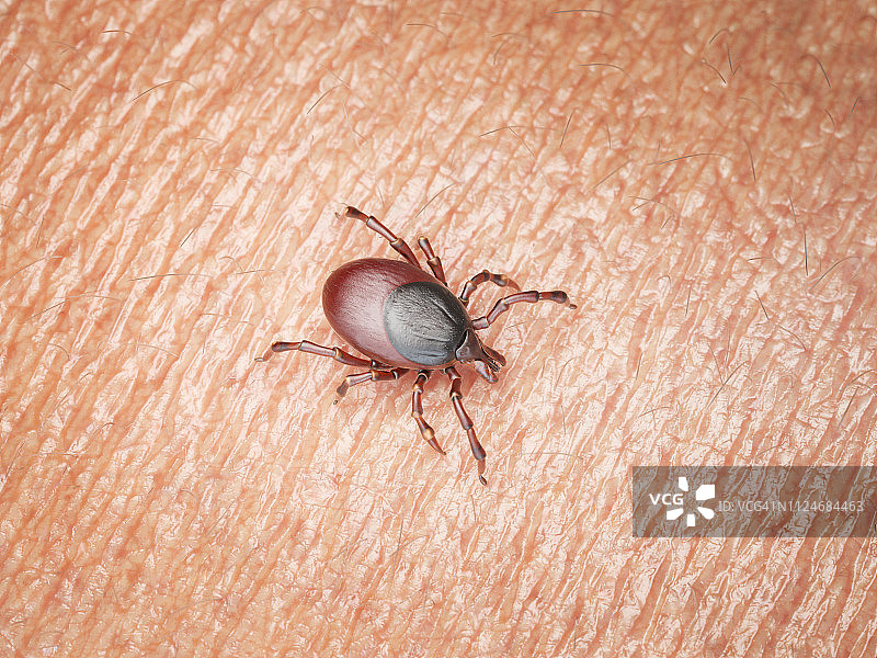 在人体皮肤上爬行的蜱虫插画图片素材