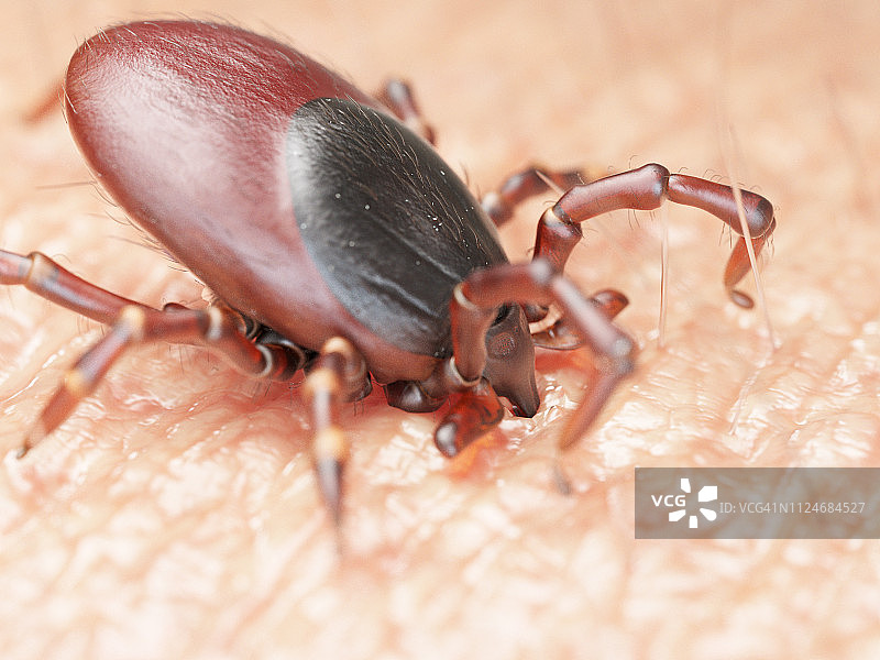 蜱虫叮咬人皮肤的插画图片素材