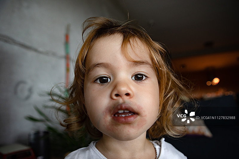 患有过敏症的小宝宝肖像图片素材