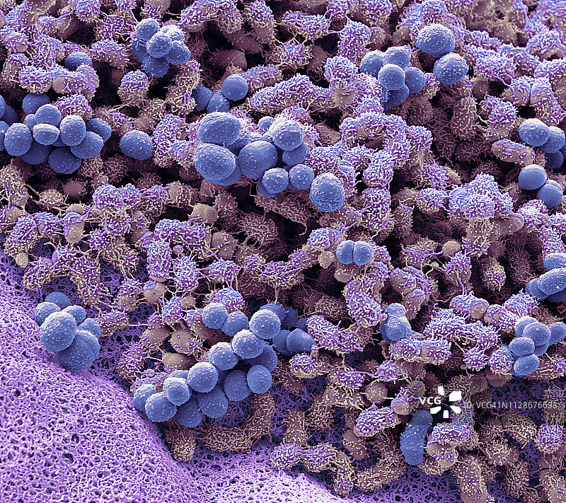 足部细菌（扫描电子显微镜）图片素材