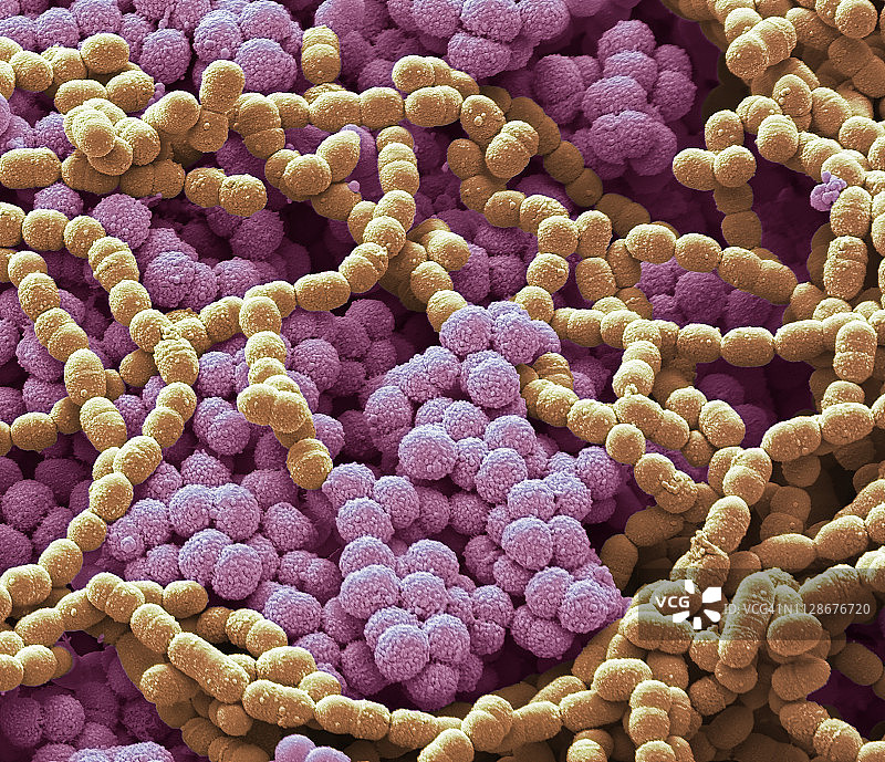 痰培养，扫描电子显微镜图片素材