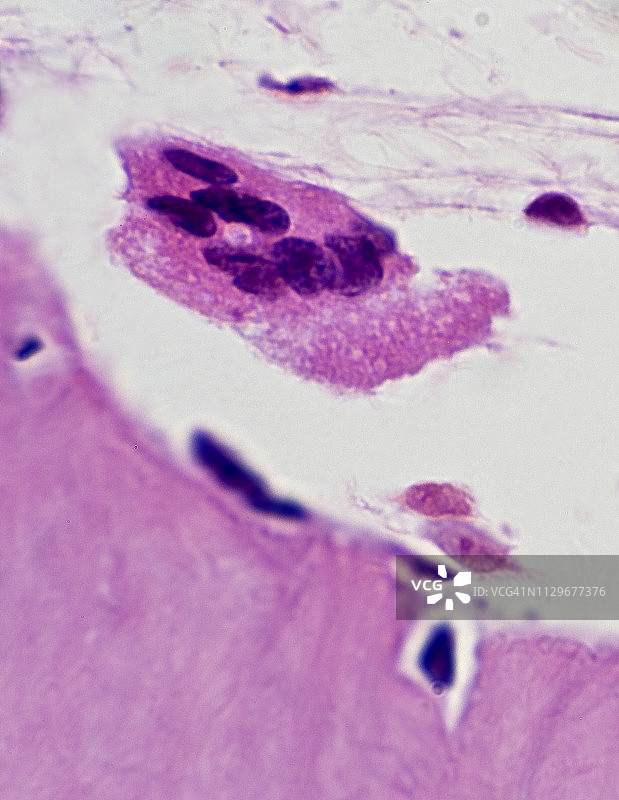 破骨细胞（骨破坏细胞），骨吸收，400倍图片素材