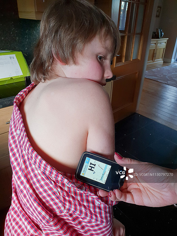 儿童糖尿病图片素材