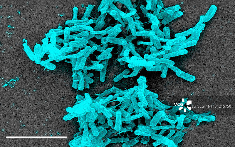 难辨梭状芽孢杆菌的SEM图像图片素材