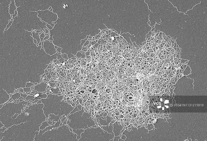 疏螺旋体细菌的扫描电镜图图片素材