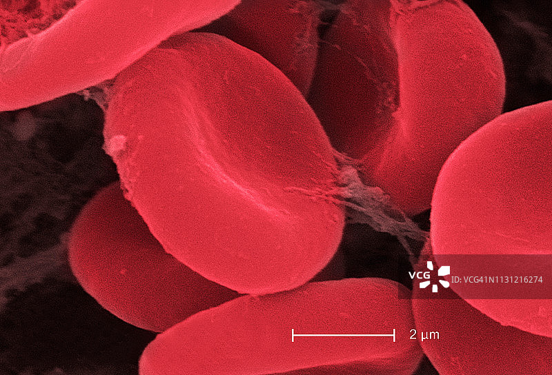 红细胞和纤维蛋白的电子显微照片图片素材