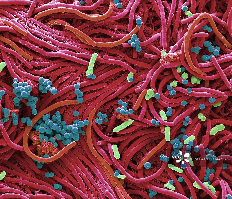 手机上的细菌，扫描电镜照片图片素材