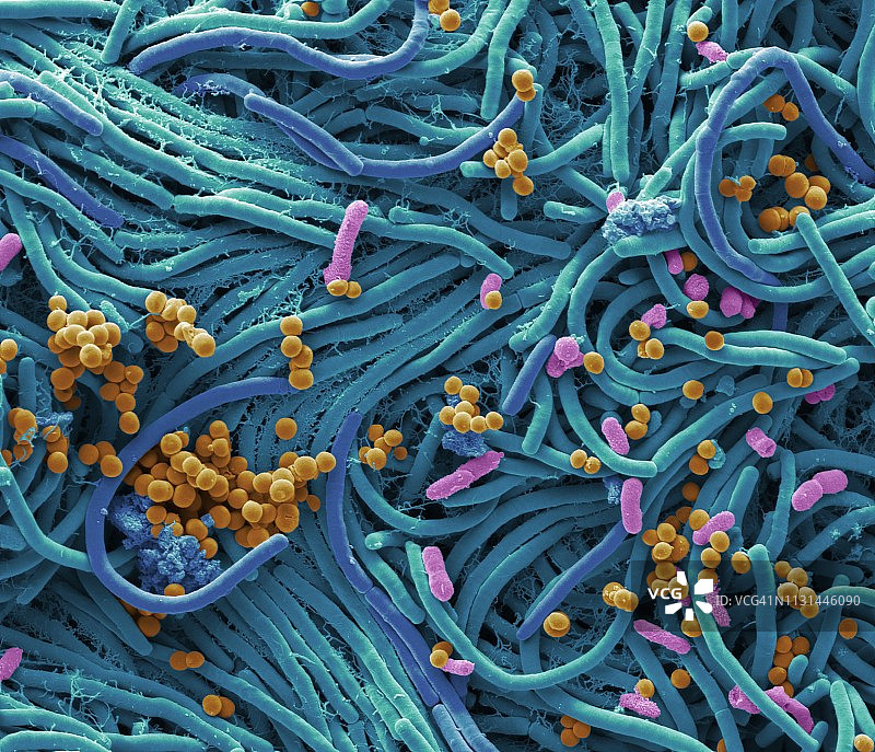 手机上的细菌，扫描电镜照片图片素材