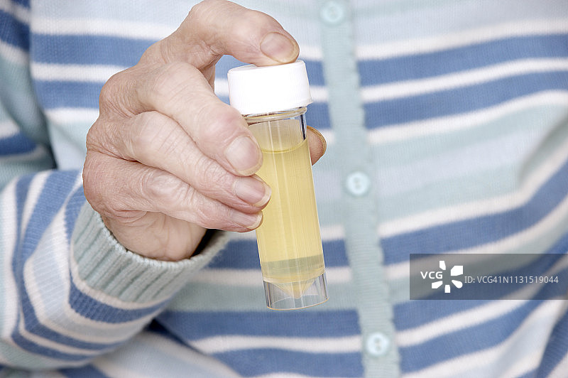 拿着装有尿液样本的无菌通用容器，准备进行分析的老年妇女图片素材