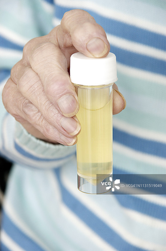 拿着装有尿液样本的无菌通用容器，准备进行分析的老年妇女图片素材