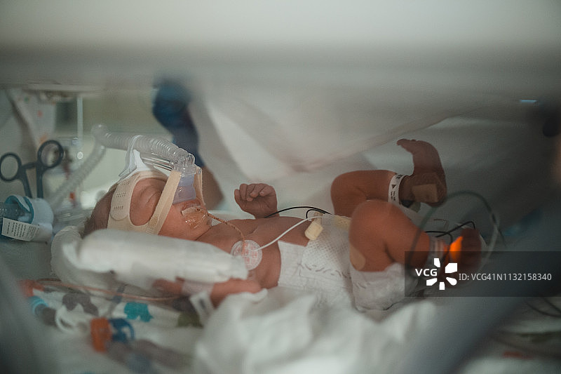 新生儿监护室护士治疗婴儿图片素材