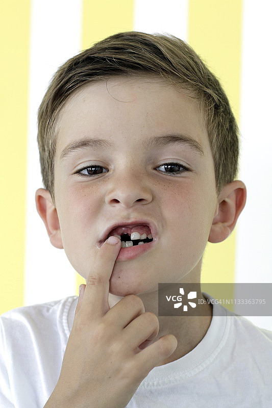 男孩展示掉落的牙齿图片素材