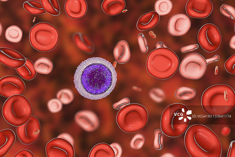 贫血症的输血后血液图图片素材