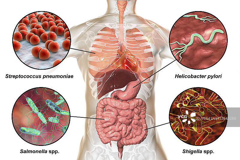 引起人类感染的细菌，图示图片素材